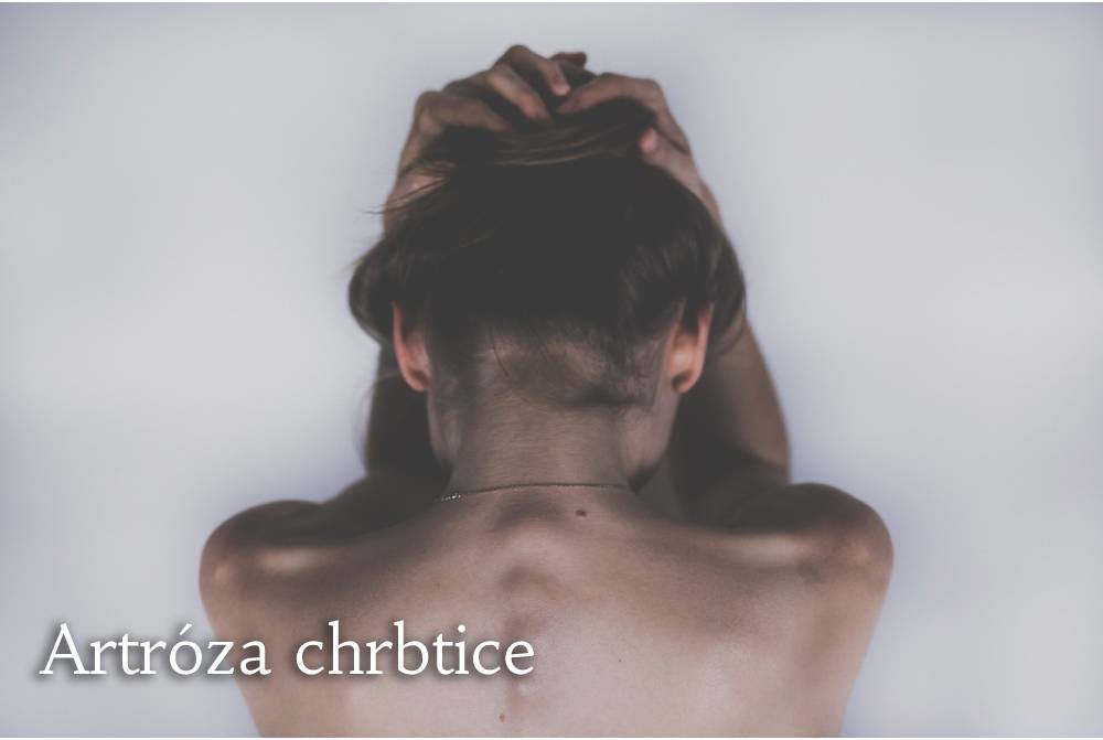 artroza chrbtice